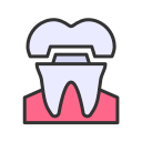 歯冠