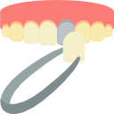 dentalfurnier