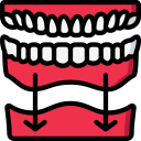 implant dentystyczny