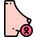 Breast cancer