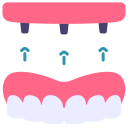 impianto dentale