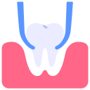 tand extractie