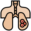 cancer du poumon