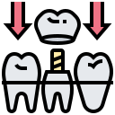 歯冠
