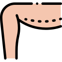 brachioplastie