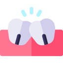 tanden
