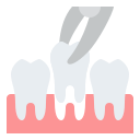 tand extractie
