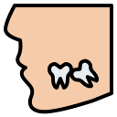 Wisdom tooth