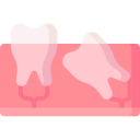 dente de siso