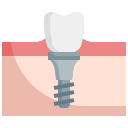 Dental implant