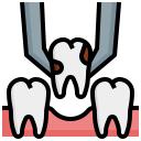 estrazione di un dente