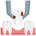 extracción dental