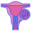 자궁 경부암