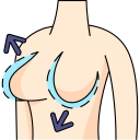 Breast implant