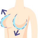 乳房インプラント