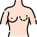 乳房切除術