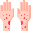 Rash