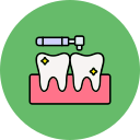 歯のクリーニング