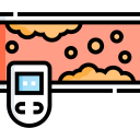 cholesterol