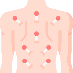 acupuncture Icône