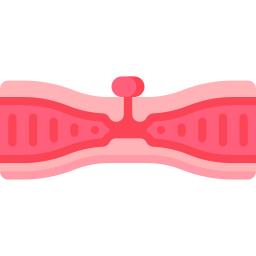 Intestinal stenosis icon