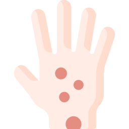 Smallpox icon