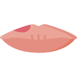 lip icoon