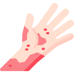 皮膚の発疹 icon