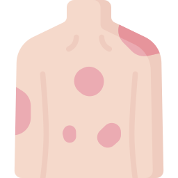 eczema icono