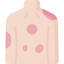 Eczema icon