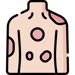湿疹 icon