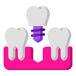 Implantar Ícone