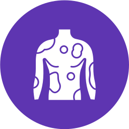 irritación icono