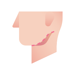 顎の輪郭形成 icon