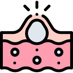 Acne icon