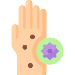 皮膚ガン icon
