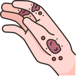 dermatitis icon