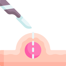 Cyst removal icon