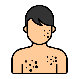 Chickenpox icon