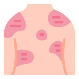 Psoriasis icon