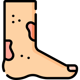 Dermatitis icon