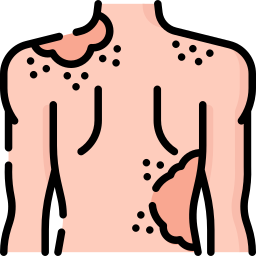 피부암 icon