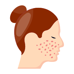 acne Ícone