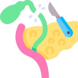 cholecystektomia ikona