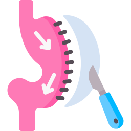 Sleeve gastrectomy icon