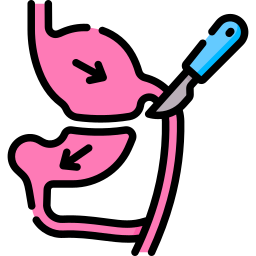 Biliopancreatic diversion icon