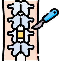 laminectomie Icône