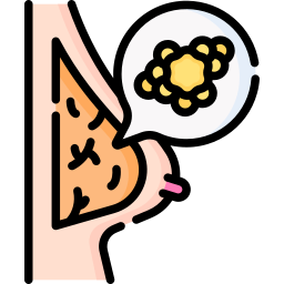 乳腺炎 icon