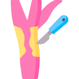 Carotid endarterectomy icon