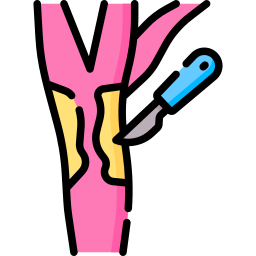 Carotid endarterectomy icon